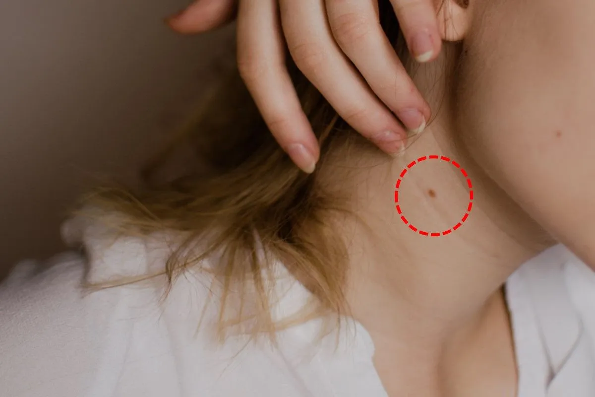 birthmark-mole-on-the-neck-meaning-female-male-back-front-sides-astrology