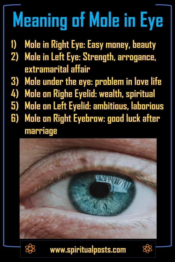 mole-in-eyelid-eyeball-under-eye-above-eye-meaning-myths-superstition