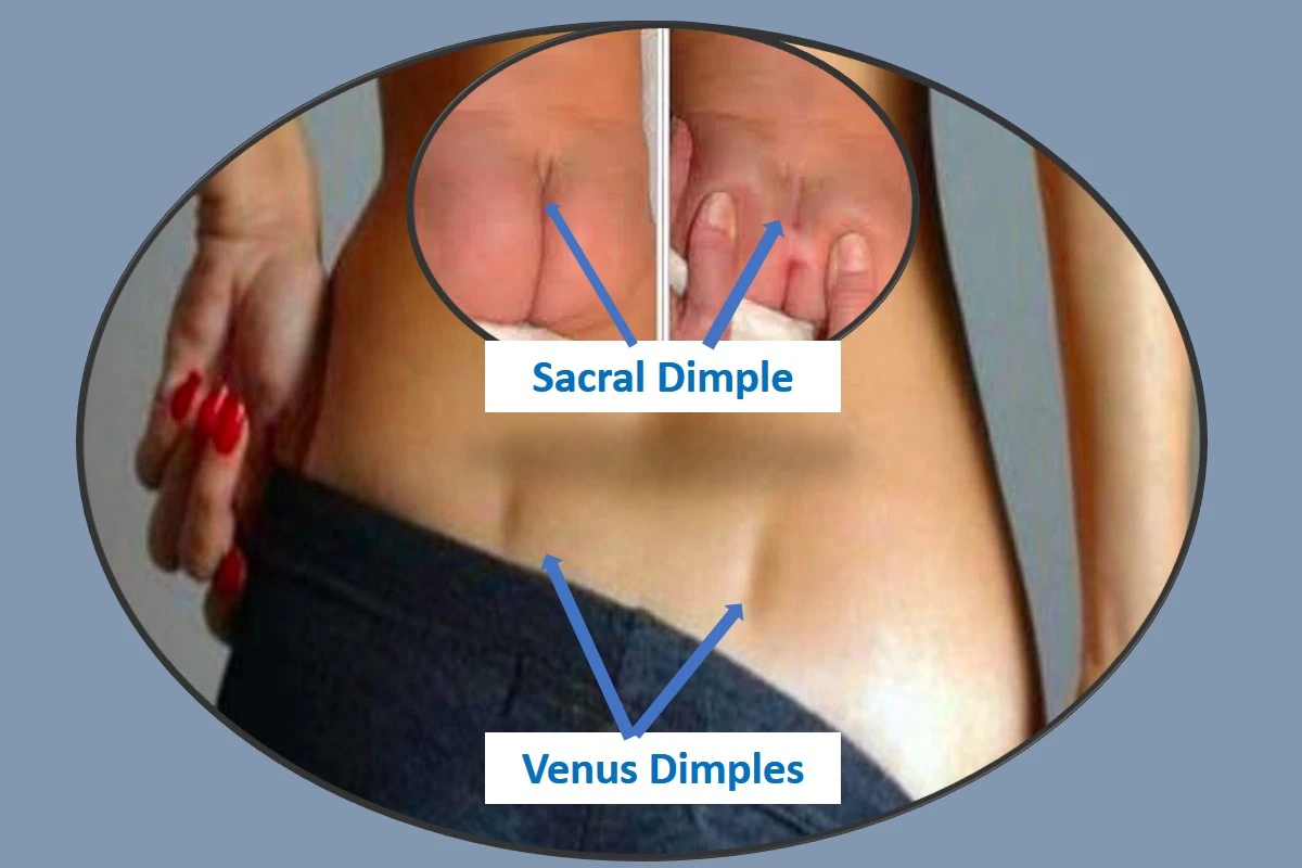 venus-dimples-sacral-dimple-spiritual-meaning-symbolism