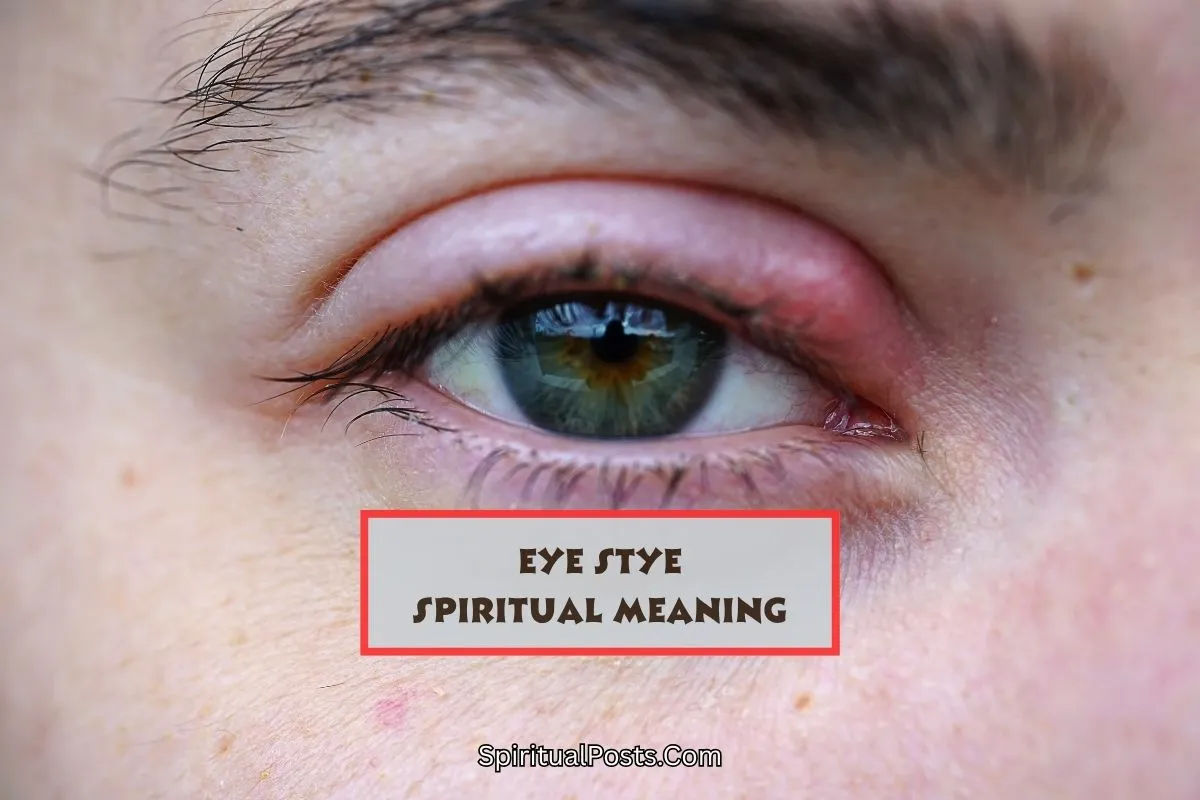 spiritual-meaning-of-eye-stye